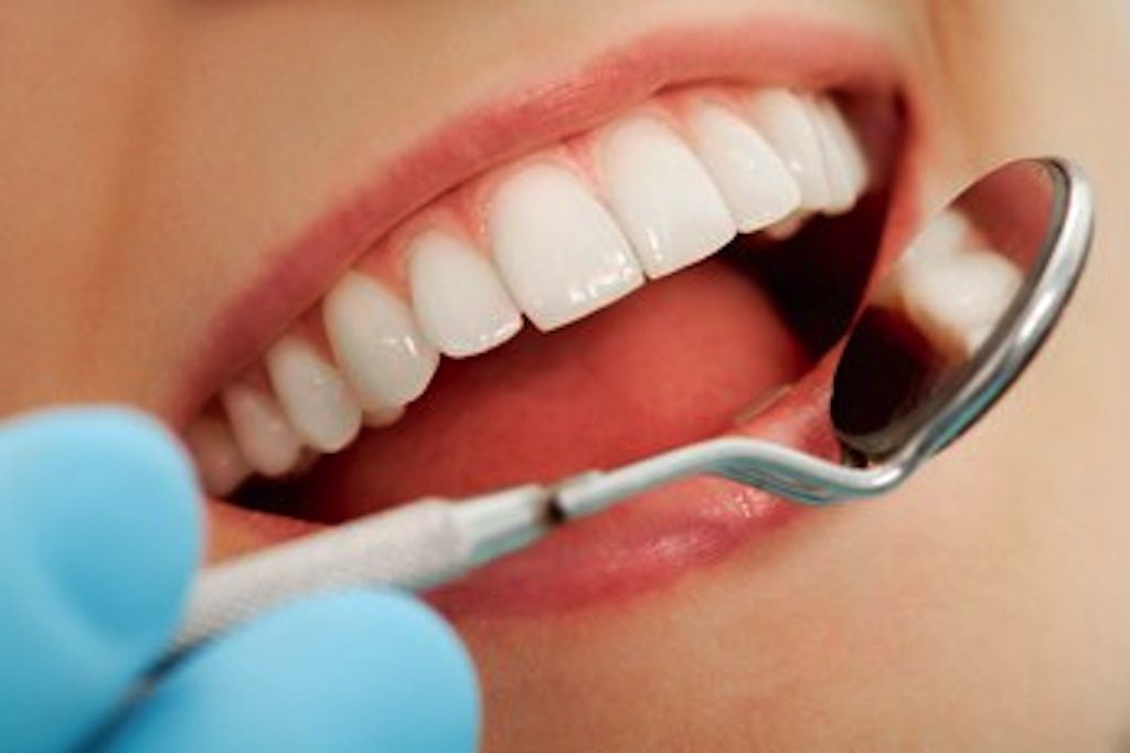 A woman's teeth are being cleaned with a spoon, showcasing the importance of dental insurance.